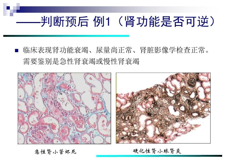 ce8b292530d0088c351d3e2b25238a01__fallback_source=1&height=1280&mount_node_token=CQxTdhK2xoK9Hqx7CmAcH94snAd&mount_point=docx_image&policy=allow_down&width=1280